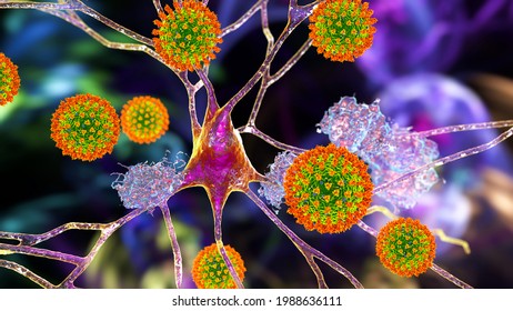 Covid-19 And Dementia. Neuropsychiatric Sequelae Of Covid-19. 3D Illustration. Coronaviruses Damaging Neurons. Amyloid Plaques In Brain Tissue As A Sign Of Neurodegeneration.