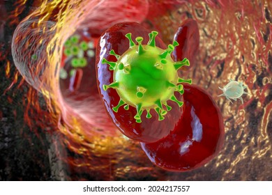 COVID-19 Virus Particles And Activated Platelets In Blood Stream Participating In Clot Formation, Conceptual 3D Illustration. Covid-19 Disease And Vaccine Complications, Thrombosis, Thromboembolism