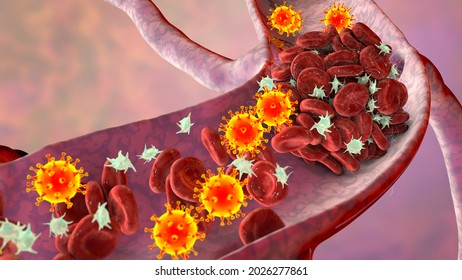 COVID-19 virus particles and activated platelets in blood stream participating in clot formation, conceptual 3D illustration. Covid-19 disease and vaccine complications, thrombosis, thromboembolism