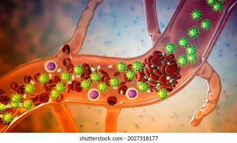 COVID-19 Virus Particles And Activated Platelets In Blood Stream Participating In Clot Formation, Conceptual 3D Illustration. Covid-19 Disease And Vaccine Complications, Thrombosis, Thromboembolism