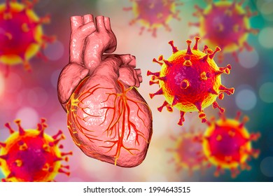 COVID-19-Viren, die das Herz befallen, konzeptionelle 3D-Illustration. Herzkomplikationen im Zusammenhang mit der COVID-19-Coronavirus-Krankheit. Die negative Wirkung des SARS-CoV-2-Virus auf das menschliche Herz.