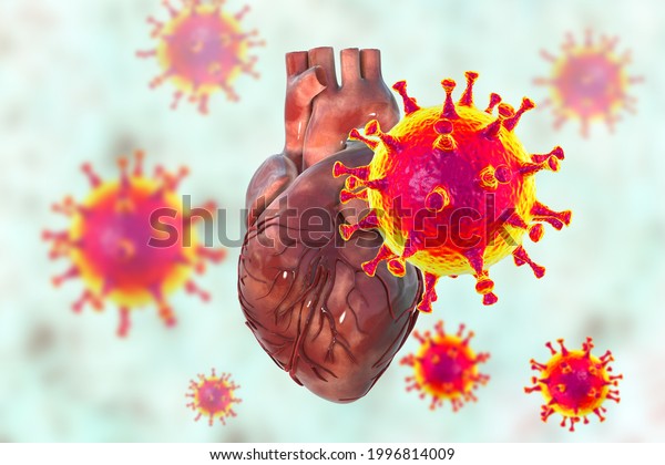 COVID-19 viruses affecting the heart, conceptual\
3D illustration. Heart complications associated with COVID-19\
coronavirus disease. The negative effect of SARS-CoV-2 virus on the\
human heart.