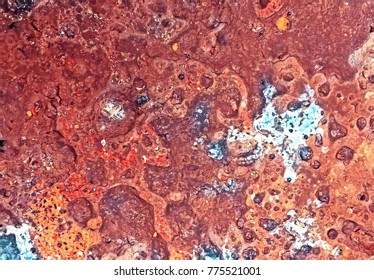 Phagocytosis Macrophage Engulfing Bacteria Different Shapes Stock ...