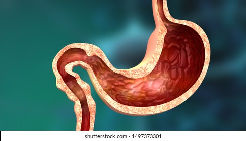 Cross Section Of Human Stomach. 3d Illustration	