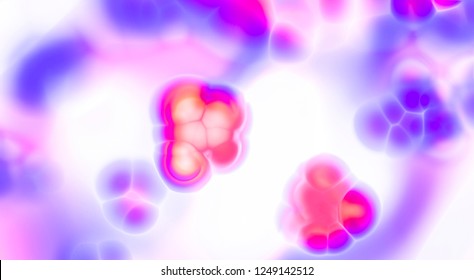 Cross section of the tissue in the microscopic view, cancer of a human. Cross section of the human tissue in the microscope view.Medical concept. Basal cell carcinoma cancer skin