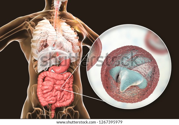 crypto three weeks of severe diarrhea