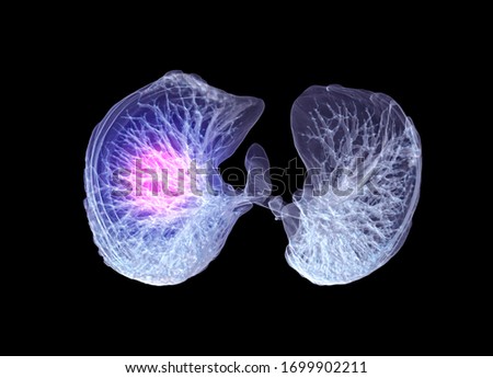 CT Chest or Lung 3D rendering image buttom view for diagnosis TB,tuberculosis and covid-19 .