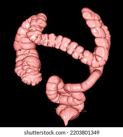 Ct Colonography Ct Colonography 3d Rendering Stock Illustration ...