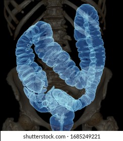 CT Colonography  Or CT Scan Of Colon 3D Rendering Image AP View  Showing Colon For Screening Colorectal Cancer. Check Up Screening Colon Cancer.

