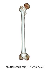 CT Scan Of Femur Bone Og Thigh Bone 3D Rendering For Diagnosis Fracture Of Femur Bone Isolated On White Background. Clipping Path.