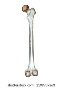 CT Scan Of Femur Bone Og Thigh Bone 3D Rendering For Diagnosis Fracture Of Femur Bone Isolated On White Background. Clipping Path.