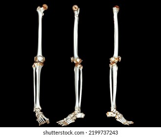 Ct Scan Lower Extremity 3d Diagnosis Stock Illustration 2199737243 ...