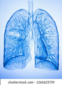 CT Scan Lung 3D