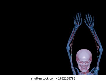 CTA Brachial Artery Or CT Scan Of Upper Extremity Or The Arm 3d Rendering Image On Black Background.