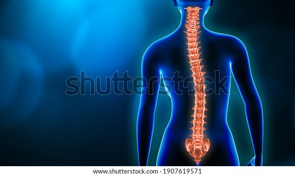 Curvature of the spine and\
woman body back view 3D rendering illustration with copy space.\
Spine disorder, scoliosis, backbone injury, human anatomy and\
medical\
concepts.