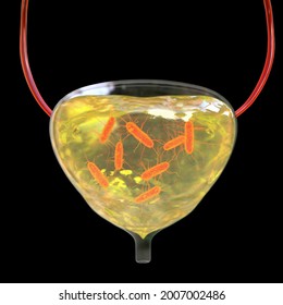 Cystitis, bacterial infection of urinary bladder, conceptual 3D illustration showing bacteria floating in urine