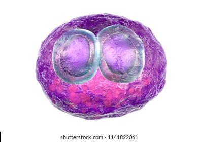 Cytomegalovirus CMV In Human Cell, Owl's Eye Inclusion In Nucleus, Multinucleated Cell, 3D Illustration. It Is Herpes Virus, Causes Disease In Fetus, Organ Transplant Patients, HIV Infected People