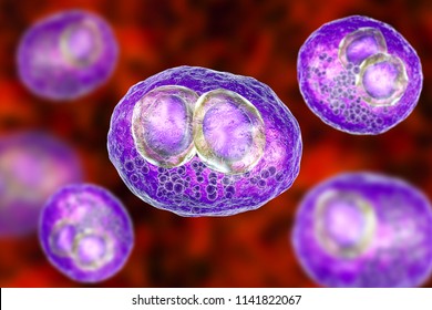 Cytomegalovirus CMV In Human Cell, Owl's Eye Inclusion In Nucleus, Multinucleated Cell, 3D Illustration. It Is Herpes Virus, Causes Disease In Fetus, Organ Transplant Patients, HIV Infected People