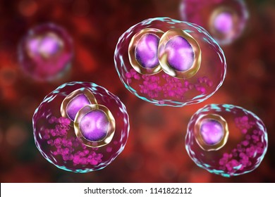 Cytomegalovirus CMV In Human Cell, Owl's Eye Inclusion In Nucleus, Multinucleated Cell, 3D Illustration. It Is Herpes Virus, Causes Disease In Fetus, Organ Transplant Patients, HIV Infected People