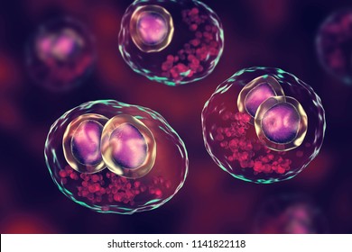 Cytomegalovirus CMV In Human Cell, Owl's Eye Inclusion In Nucleus, Multinucleated Cell, 3D Illustration. It Is Herpes Virus, Causes Disease In Fetus, Organ Transplant Patients, HIV Infected People