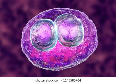 Cytomegalovirus CMV In Human Cell, Owl's Eye Inclusion In Nucleus, Multinucleated Cell, 3D Illustration. It Is Herpes Virus, Causes Disease In Fetus, Organ Transplant Patients, HIV Infected People