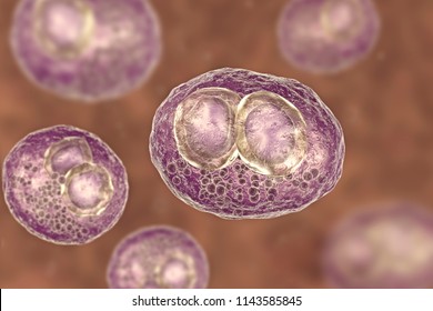 Cytomegalovirus CMV In Human Cell, Owl's Eye Inclusion In Nucleus, Multinucleated Cell, 3D Illustration. It Is Herpes Virus, Causes Disease In Fetus, Organ Transplant Patients, HIV Infected People