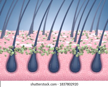 Dandruff Prevention And Antifungal Treatment, 3d Illustration Of Human Scalp Hair Roots And Fungal Infection