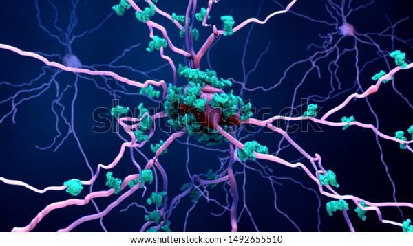 老化した脳のニューロンの死 またはニューロンのタンパク質の3dイラスト のイラスト素材