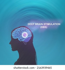 Deep brain stimulation. Human head silhouette with glowing brain. DBS