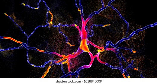 Degeneration of dopaminergic neuron, a key stage of development of Parkinson's disease, 3D illustration