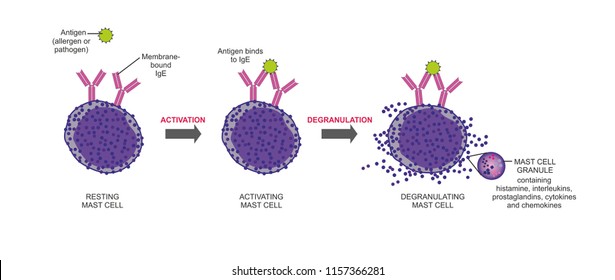 The degranulation is an inflammatory process in mast cells.
Antigen interaction with IgE molecules on the cell membrane triggers cells to release mediators such as histamine.