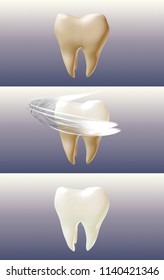 Dental bleaching procedure  Tooth cleaning  Step by step illustration  Before   after effect  3d render  