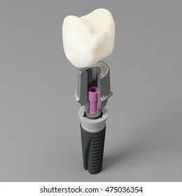 dental care 3d rendering