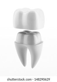 Dental Crown And Tooth