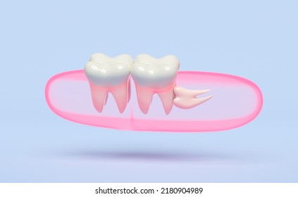 Dental Examination Of The Dentist, 3d Wisdom Teeth Model Problems Icon With Gums Isolated On Blue Background. Health Of White Teeth, Oral Care, 3d Render Illustration