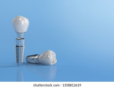 Dental implant close-up and isolated on blue background with copy space. 3d illustration. artificial tooth root that embed in the bone of the jaw to support artificial crown.