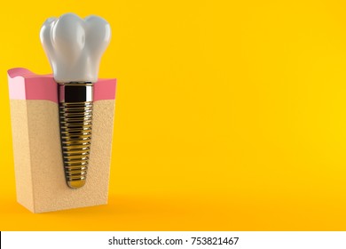 Dental implant isolated on orange background. 3d illustration