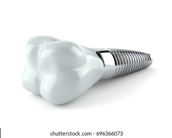 Dental implant isolated on white background. 3d illustration