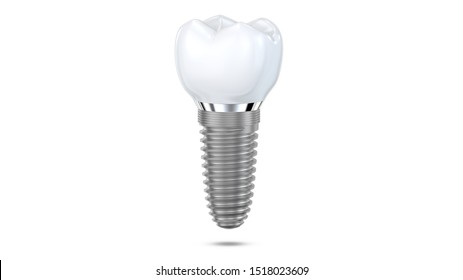 Dental implant model of molar tooth levitate at the air as a concept of implantation teeth and dental surgery. 3d rendering illustration isolated on white background