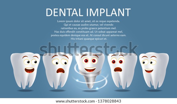 歯科用インプラントポスターバナーテンプレート リアルなイラスト 健康な人の歯と歯のプロテーゼ 歯の修復の置き換えのコンセプト のイラスト素材