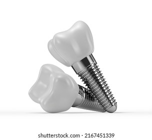 Dental Implants Isolated On White Background Stock Illustration ...