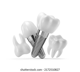 Dental Implants Isolated On White Background Stock Illustration ...