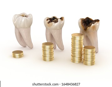 Dental Restoration Graph. 3D Illustration Concept
