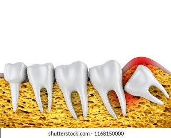 抜歯 のイラスト素材 画像 ベクター画像 Shutterstock