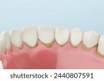 Dental tartar adhering to lower front teeth, oral hygiene and professional dental care concept.