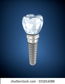 Dental Titanium Implant 