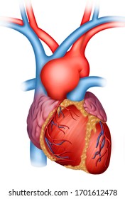 Descriptive illustration of an aortic aneurysm, showing localized, weakened, or defective dilatation of the aortic artery wall.