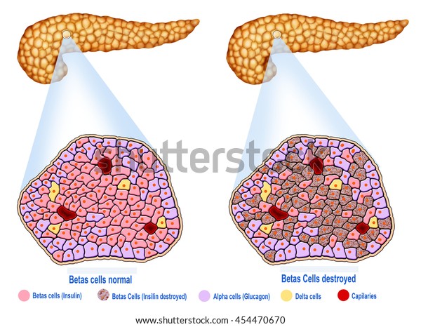 Descriptive Illustration Pancreas Pancreatic Islets Stock Illustration ...