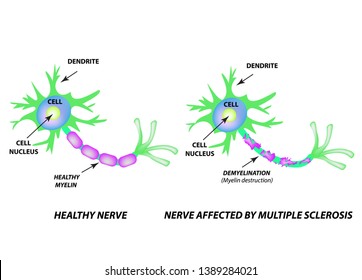 190 Myelinated nerve fiber Images, Stock Photos & Vectors | Shutterstock