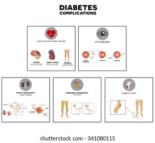 Diabetes complications affected organs info graphic